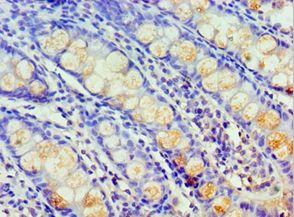 HARS Antibody - Immunohistochemistry of paraffin-embedded human rectum using antibody at 1:100 dilution.