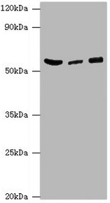 HARS Antibody - Western blot All lanes: HARS antibody at 6µg/ml Lane 1: Hela whole cell lysate Lane 2: K562 whole cell lysate Lane 3: 293T whole cell lysate Secondary Goat polyclonal to rabbit IgG at 1/10000 dilution Predicted band size: 58, 53, 51, 55 kDa Observed band size: 58 kDa