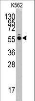 HARS Antibody - Western blot of anti-HARS antibody in K562 cell line lysates (35 ug/lane). HARS (arrow) was detected using the purified antibody.