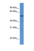 HARS Antibody - HARS antibody Western blot of 293T Cell lysate. Antibody concentration 1 ug/ml.  This image was taken for the unconjugated form of this product. Other forms have not been tested.