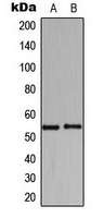 HARS Antibody - Western blot analysis of HARS expression in K562 (A); Raw264.7 (B) whole cell lysates.