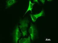 HARS Antibody - Immunostaining analysis in HeLa cells. HeLa cells were fixed with 4% paraformaldehyde and permeabilized with 0.1% Triton X-100 in PBS. The cells were immunostained with anti-HARS mAb.