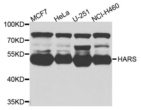 HARS Antibody - Western blot analysis of extracts of various cells.