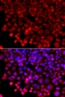 HARS Antibody - Immunofluorescence analysis of A549 cells.