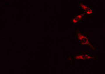 HARS Antibody - Staining HeLa cells by IF/ICC. The samples were fixed with PFA and permeabilized in 0.1% Triton X-100, then blocked in 10% serum for 45 min at 25°C. The primary antibody was diluted at 1:200 and incubated with the sample for 1 hour at 37°C. An Alexa Fluor 594 conjugated goat anti-rabbit IgG (H+L) antibody, diluted at 1/600, was used as secondary antibody.