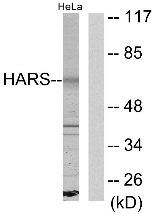 HARS Antibody - Western blot analysis of extracts from HeLa cells, using HARS antibody.