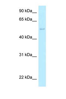 HARS2 Antibody - HARS2 / HisRS antibody Western blot of HeLa Cell lysate. Antibody concentration 1 ug/ml.  This image was taken for the unconjugated form of this product. Other forms have not been tested.