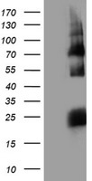 HARS2 Antibody - HEK293T cells were transfected with the pCMV6-ENTRY control (Left lane) or pCMV6-ENTRY HARS2 (Right lane) cDNA for 48 hrs and lysed. Equivalent amounts of cell lysates (5 ug per lane) were separated by SDS-PAGE and immunoblotted with anti-HARS2.