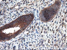 HARS2 Antibody - IHC of paraffin-embedded Human endometrium tissue using anti-HARS2 mouse monoclonal antibody.