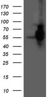 HARS2 Antibody - HEK293T cells were transfected with the pCMV6-ENTRY control (Left lane) or pCMV6-ENTRY HARS2 (Right lane) cDNA for 48 hrs and lysed. Equivalent amounts of cell lysates (5 ug per lane) were separated by SDS-PAGE and immunoblotted with anti-HARS2.