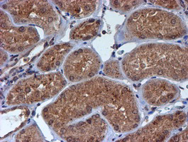 HARS2 Antibody - IHC of paraffin-embedded Human Kidney tissue using anti-HARS2 mouse monoclonal antibody.
