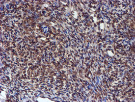 HARS2 Antibody - IHC of paraffin-embedded Human Ovary tissue using anti-HARS2 mouse monoclonal antibody.