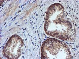 HARS2 Antibody - IHC of paraffin-embedded Human prostate tissue using anti-HARS2 mouse monoclonal antibody.