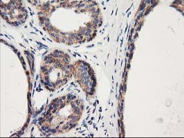 HARS2 Antibody - IHC of paraffin-embedded Human breast tissue using anti-HARS2 mouse monoclonal antibody.
