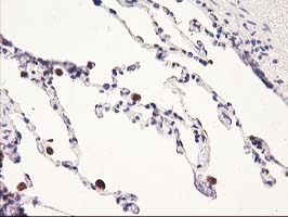 HARS2 Antibody - IHC of paraffin-embedded Human lung tissue using anti-HARS2 mouse monoclonal antibody.