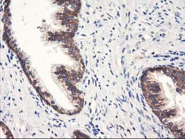 HARS2 Antibody - IHC of paraffin-embedded Human prostate tissue using anti-HARS2 mouse monoclonal antibody.