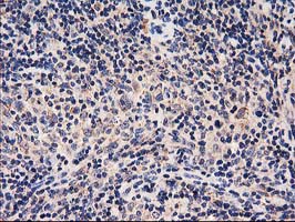 HARS2 Antibody - IHC of paraffin-embedded Human lymphoma tissue using anti-HARS2 mouse monoclonal antibody.
