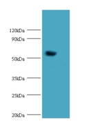 HARS2 Antibody - Western blot of Probable histidine--tRNA ligase, mitochondrial antibody at 2 ug/ml with mouse kidney tissue. Secondary: Goat polyclonal to Rabbit IgG at 1:10000 dilution. Predicted band size: 57.  This image was taken for the unconjugated form of this product. Other forms have not been tested.