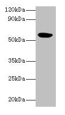 HARS2 Antibody - Western blot All lanes: Probable histidine--tRNA ligase, mitochondrial antibody at 2µg/ml + Mouse kidney tissue Secondary Goat polyclonal to rabbit IgG at 1/10000 dilution Predicted band size: 57, 55 kDa Observed band size: 57 kDa