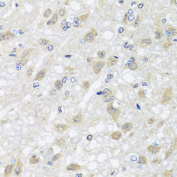 HARS2 Antibody - Immunohistochemistry of paraffin-embedded rat brain tissue.