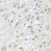 HARS2 Antibody - Immunohistochemistry of paraffin-embedded rat brain tissue.