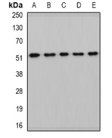 HARS2 Antibody - Western blot analysis of HARS2 expression in HepG2 (A); mouse kidney (B); mouse heart (C); rat liver (D); rat brain (E) whole cell lysates.