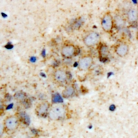 HARS2 Antibody - Immunohistochemical analysis of HARS2 staining in rat brain formalin fixed paraffin embedded tissue section. The section was pre-treated using heat mediated antigen retrieval with sodium citrate buffer (pH 6.0). The section was then incubated with the antibody at room temperature and detected using an HRP conjugated compact polymer system. DAB was used as the chromogen. The section was then counterstained with hematoxylin and mounted with DPX.