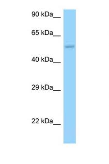 HARS2 Antibody - HARS2 / HisRS antibody Western blot of PANC1 Cell lysate. Antibody concentration 1 ug/ml.  This image was taken for the unconjugated form of this product. Other forms have not been tested.