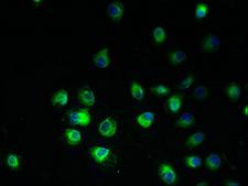 HARV1 / ARV1 Antibody - Immunofluorescent analysis of A2780 cells using ARV1 Antibody at dilution of 1:100 and Alexa Fluor 488-congugated AffiniPure Goat Anti-Rabbit IgG(H+L)