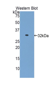 HAS1 / HAS Antibody - Western blot of recombinant HAS1 / HAS.  This image was taken for the unconjugated form of this product. Other forms have not been tested.