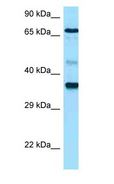 HAS1 / HAS Antibody - HAS1 / HAS antibody Western Blot of THP-1.  This image was taken for the unconjugated form of this product. Other forms have not been tested.