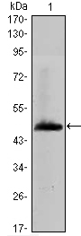 HAS1 / HAS Antibody - Western blot using HAS1 monoclonal antibody against human HAS1 (AA: 74-243) recombinant protein. (Expected MW is 44.4 kDa)