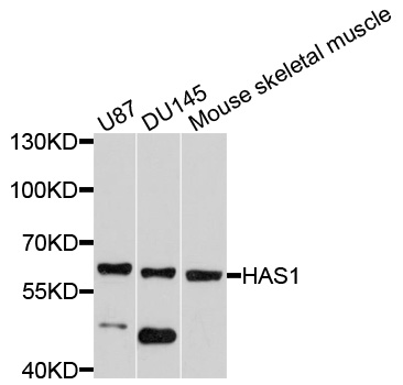 HAS1 / HAS Antibody - Western blot analysis of extracts of various cell lines, using HAS1 antibody at 1:1000 dilution. The secondary antibody used was an HRP Goat Anti-Rabbit IgG (H+L) at 1:10000 dilution. Lysates were loaded 25ug per lane and 3% nonfat dry milk in TBST was used for blocking. An ECL Kit was used for detection and the exposure time was 30s.