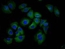 HAS1 / HAS Antibody - Immunofluorescence staining of A549 cells at a dilution of 1:100, counter-stained with DAPI. The cells were fixed in 4% formaldehyde, permeabilized using 0.2% Triton X-100 and blocked in 10% normal Goat Serum. The cells were then incubated with the antibody overnight at 4 °C.The secondary antibody was Alexa Fluor 488-congugated AffiniPure Goat Anti-Rabbit IgG (H+L) .