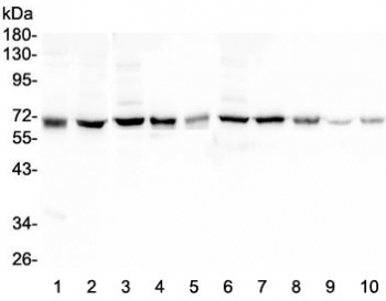 HAS1 / HAS Antibody - Western blot testing of 1) human SHG-44, 2) human ThP-1, 3) rat brain, 4) rat smooth muscle, 5) rat ovary, 6) mouse brain, 7) mouse smooth muscle, 8) mouse ovary, 9) mouse small intestine and 10) mouse Neuro-2a lysate with HAS1 antibody at 0.5ug/ml. Predicted molecular weight ~63 kDa.