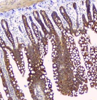 HAS1 / HAS Antibody - IHC staining of FFPE rat small intestine with HAS1 antibody at 1ug/ml. HIER: boil tissue sections in pH6, 10mM citrate buffer, for 10-20 min and allow to cool before testing.