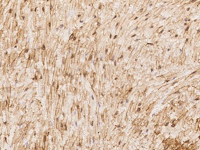HAS1 / HAS Antibody - Immunochemical staining of human HAS1 in human smooth muscle with rabbit polyclonal antibody at 1:500 dilution, formalin-fixed paraffin embedded sections.