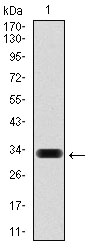 HAS3 Antibody - Western blot using HAS3 monoclonal antibody against human HAS3 (AA: 312-364) recombinant protein. (Expected MW is 32 kDa)