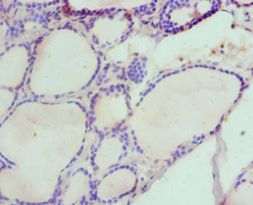 HAS3 Antibody - Immunohistochemistry of paraffin-embedded human thyroid using antibody at 1:100 dilution.