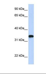 HAS3 Antibody - Transfected 293T cell lysate. Antibody concentration: 1.0 ug/ml. Gel concentration: 12%.  This image was taken for the unconjugated form of this product. Other forms have not been tested.