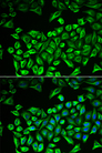 HAS3 Antibody - Immunofluorescence analysis of A549 cells.