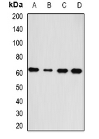 HAS3 Antibody - Western blot analysis of HAS3 expression in A549 (A); SKOV3 (B); mouse heart (C); rat liver (D) whole cell lysates.