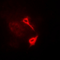 HAS3 Antibody - Immunofluorescent analysis of HAS3 staining in A549 cells. Formalin-fixed cells were permeabilized with 0.1% Triton X-100 in TBS for 5-10 minutes and blocked with 3% BSA-PBS for 30 minutes at room temperature. Cells were probed with the primary antibody in 3% BSA-PBS and incubated overnight at 4 deg C in a humidified chamber. Cells were washed with PBST and incubated with a DyLight 594-conjugated secondary antibody (red) in PBS at room temperature in the dark.