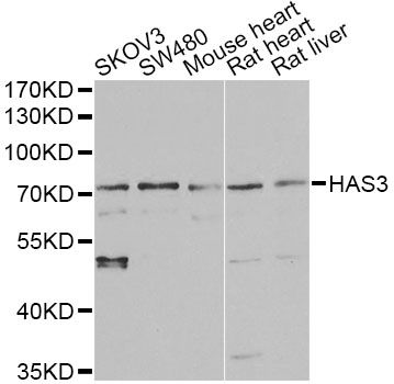 HAS3 Antibody - Western blot analysis of extracts of various cell lines, using HAS3 antibody at 1:1000 dilution. The secondary antibody used was an HRP Goat Anti-Rabbit IgG (H+L) at 1:10000 dilution. Lysates were loaded 25ug per lane and 3% nonfat dry milk in TBST was used for blocking. An ECL Kit was used for detection and the exposure time was 90s.