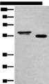 HAS3 Antibody - Western blot analysis of Human cervical cancer tissue and A549 cell lysates  using HAS3 Polyclonal Antibody at dilution of 1:400
