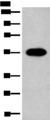 HAS3 Antibody - Western blot analysis of A549 cell lysate  using HAS3 Polyclonal Antibody at dilution of 1:300
