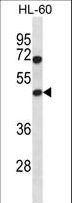 HAT1 Antibody - HAT1 Antibody western blot of HL-60 cell line lysates (35 ug/lane). The HAT1 antibody detected the HAT1 protein (arrow).