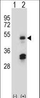 HAT1 Antibody - Western blot of HAT1 (arrow) using rabbit polyclonal HAT1 Antibody. 293 cell lysates (2 ug/lane) either nontransfected (Lane 1) or transiently transfected (Lane 2) with the HAT1 gene.