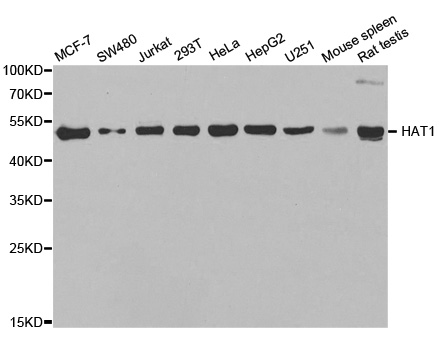 HAT1 Antibody - Western blot analysis of extracts of various cell lines.