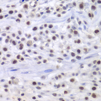 HAT1 Antibody - Immunohistochemistry of paraffin-embedded mouse cancer tissue.